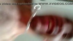 Thumb 6