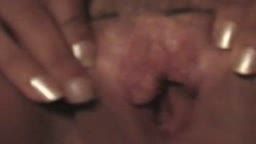 Thumb 6