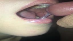 Thumb 12