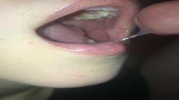 Thumb 14