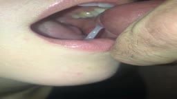 Thumb 8
