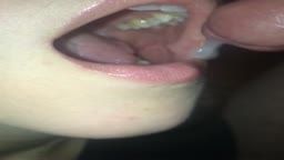 Thumb 9