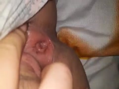 Thumb 20
